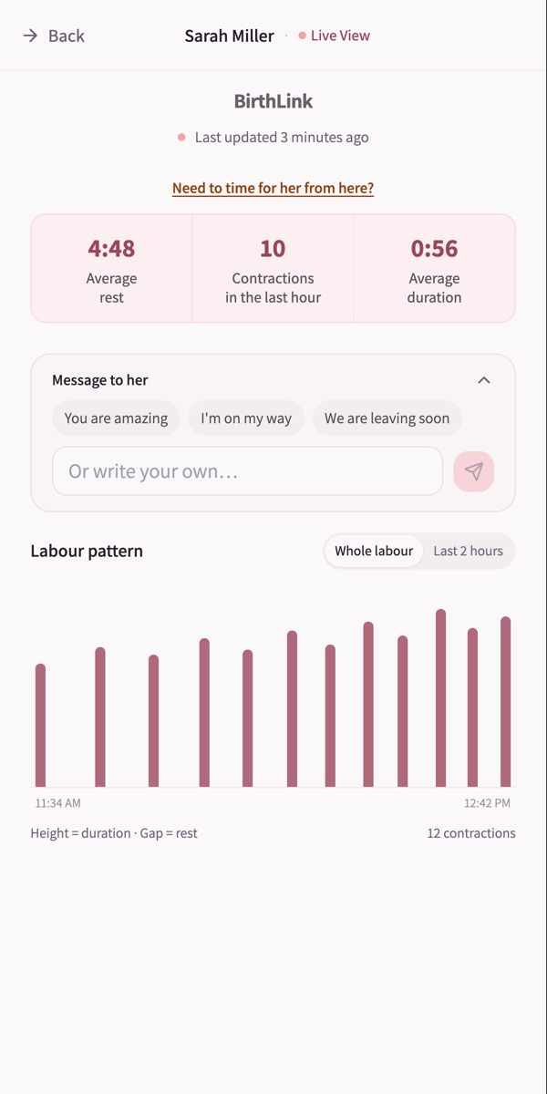 The labor pattern in the live view